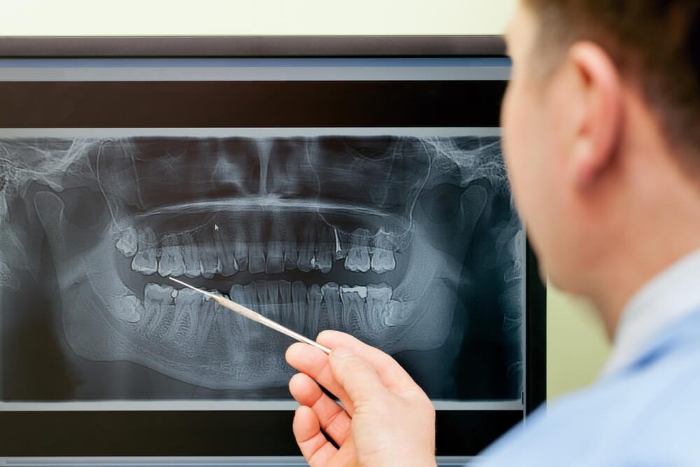 dentist examining digital x ray