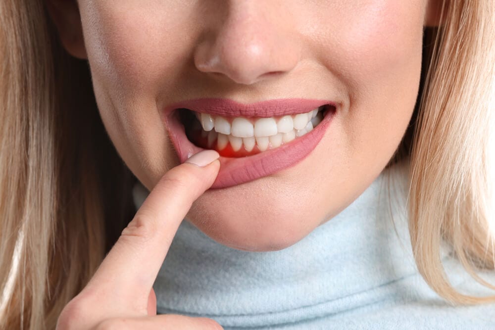 female holding gum due to periodontal pain