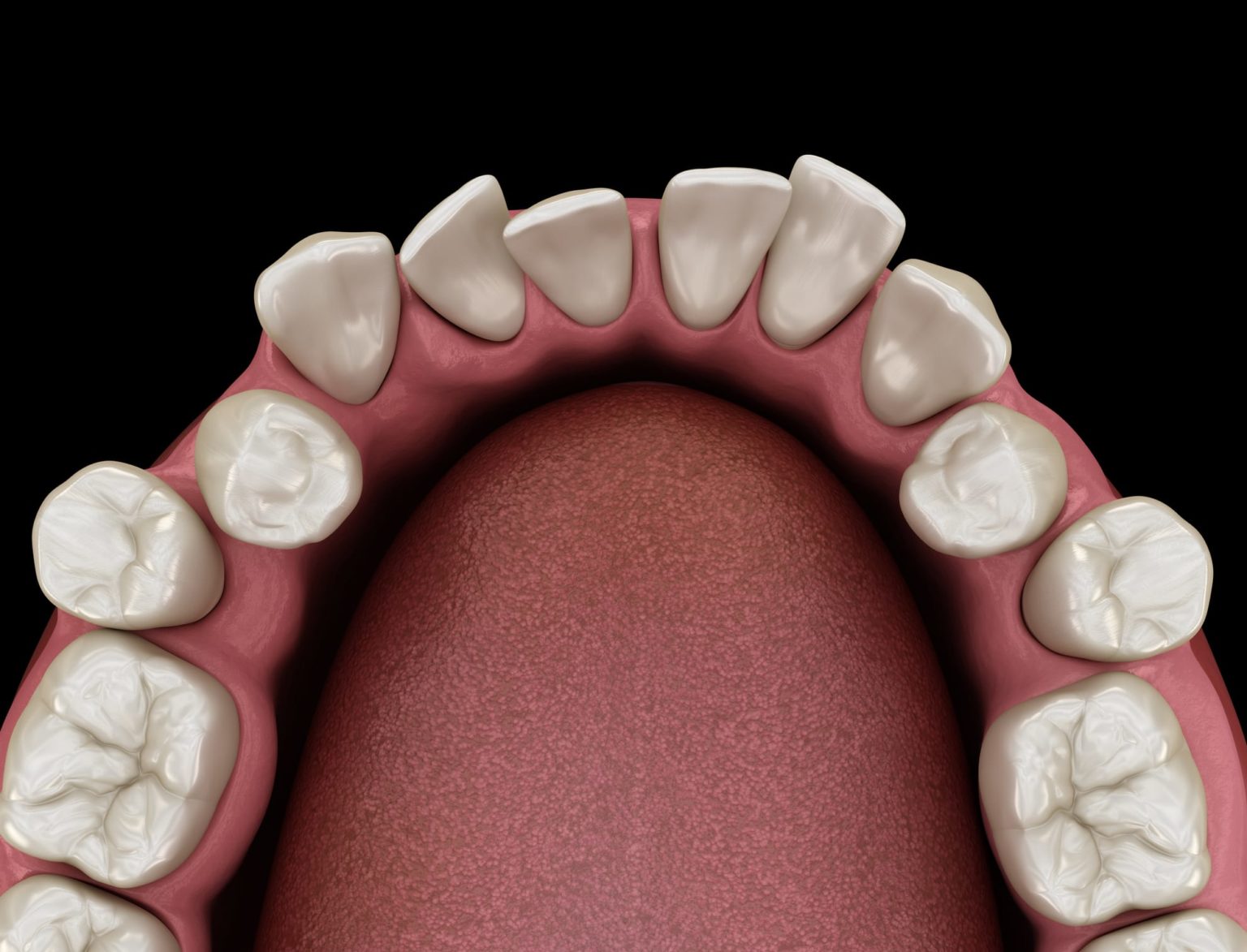 What Is A Malocclusion Broadmoor Dental